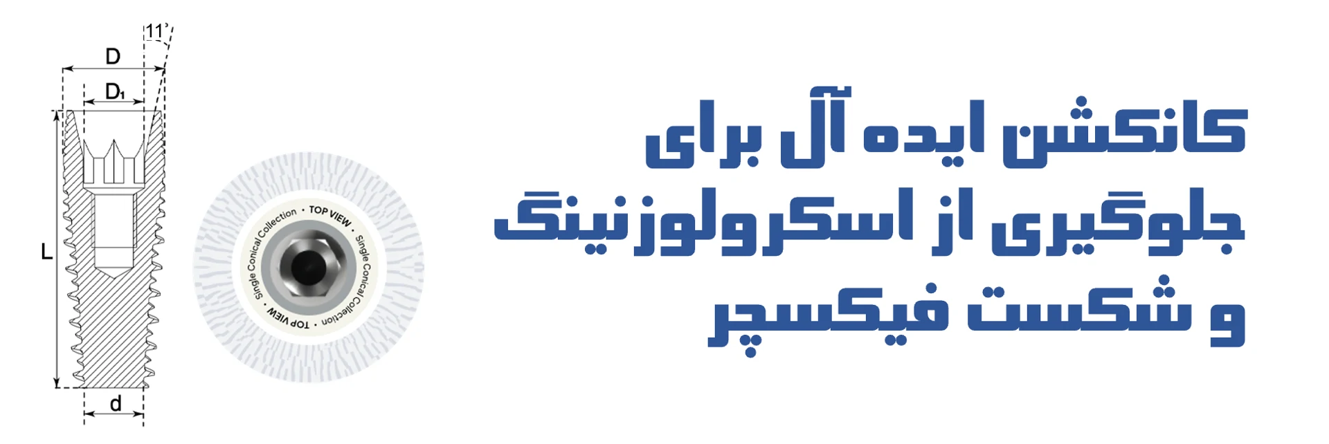 عکس کانکشن ایده آل برای جلوگیری از اسکرولوزنینگ و شکست فیکسچر
