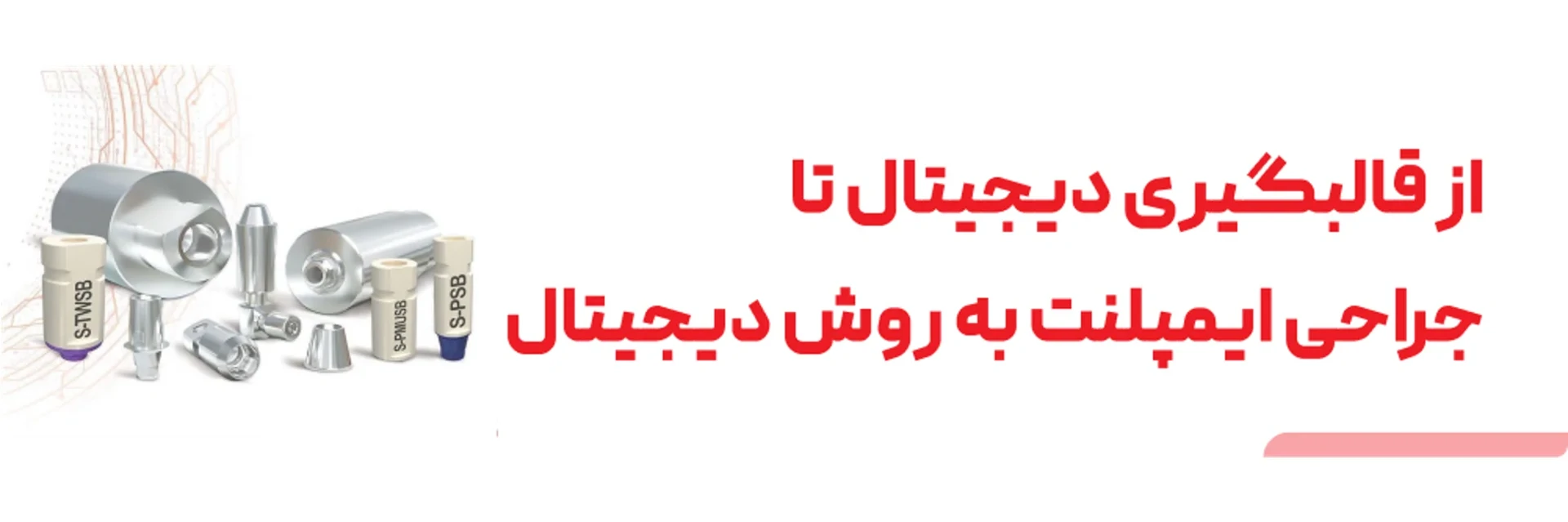 عکس از قالبگیری دیجیتال تا جراحی ایمپلنت به روش دیجیتال
