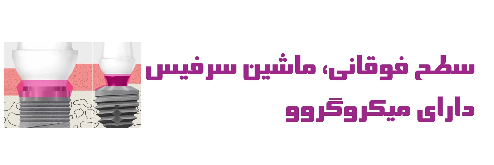 عکس سطح فوقانی، ماشین سرفیس دارای میکروگروو