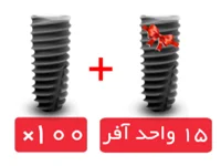 پکیج 100 واحد فیکسچر استریوس (Steri-Oss) با آفر 15 واحد فیکسچر رایگان