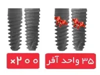 پکیج 200 واحد فیکسچر آی دو بایوتک (I Do) با آفر 35 واحد فیکسچر رایگان