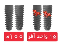 پکیج 100 واحد فیکسچر آی دو بایوتک (I Do) با آفر 15 واحد فیکسچر رایگان