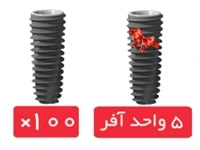 پکیج 100 واحد فیکسچر پوینت(Point) با آفر 5 واحد فیکسچر رایگان