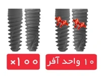 پکیج 100 واحد فیکسچر آی دو بایوتک (I Do) با آفر 10 واحد فیکسچر رایگان