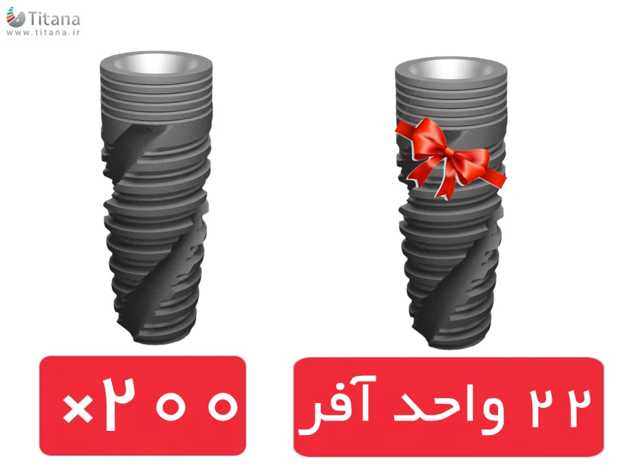 پکیج 200 واحد فیکسچر نکسیس (Naxis) با افر 22 واحد فیکسچر رایگان